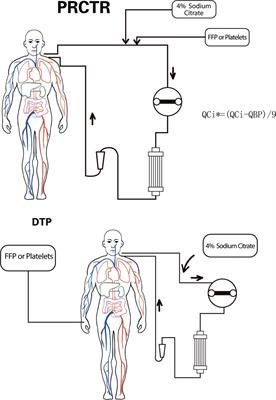 Novel blood product transfusion regimen to prevent clotting and citrate accumulation during continuous renal replacement therapy with regional citrate anticoagulation in children